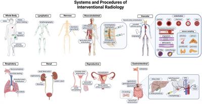 Value of interventional radiology and their contributions to modern medical systems
